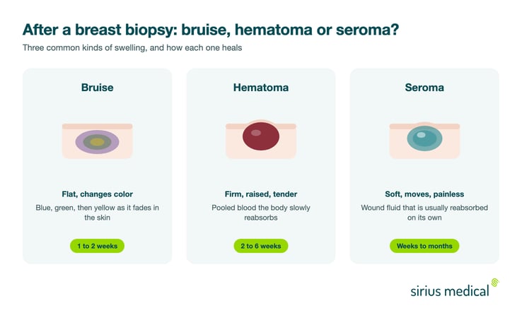 Visual comparison of a bruise, a hematoma and a seroma after a breast biopsy, showing how each looks, feels and heals
