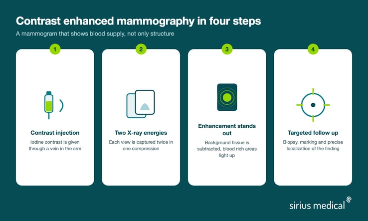 Four step overview of contrast enhanced mammography, from contrast injection and dual energy imaging to the enhanced image and targeted follow up