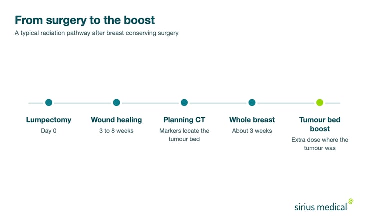 Timeline of radiation therapy after a lumpectomy, from surgery and wound healing through planning CT, whole breast irradiation and the tumor bed boost