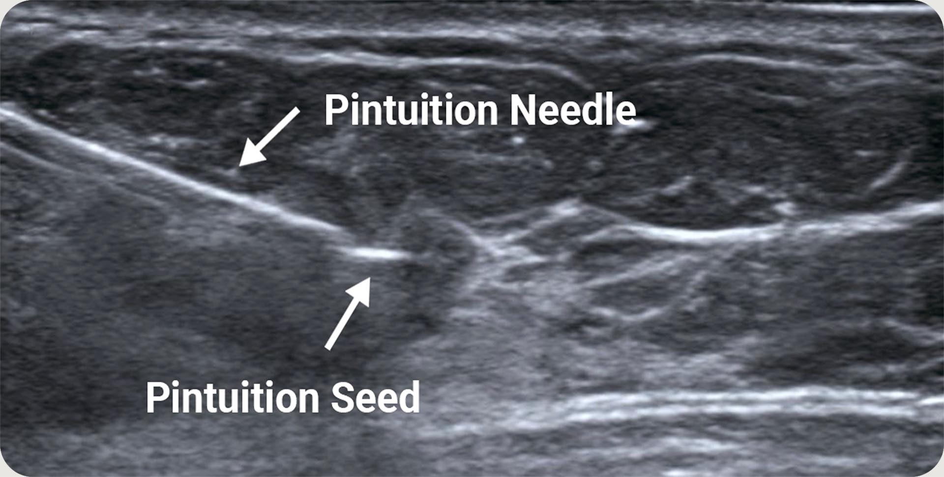 Needle-seed